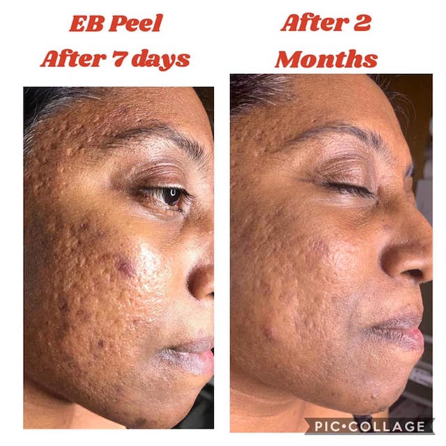 Before & After Photo 14