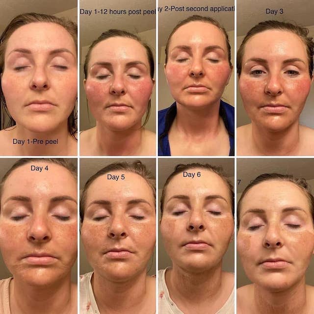 Before & After Photo 16