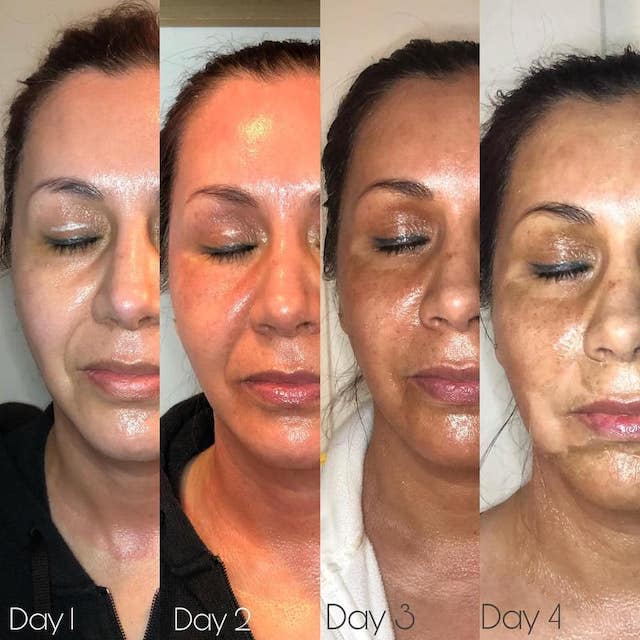 Before & After Photo 18