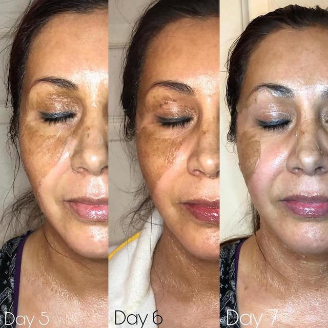 Before & After Photo 19