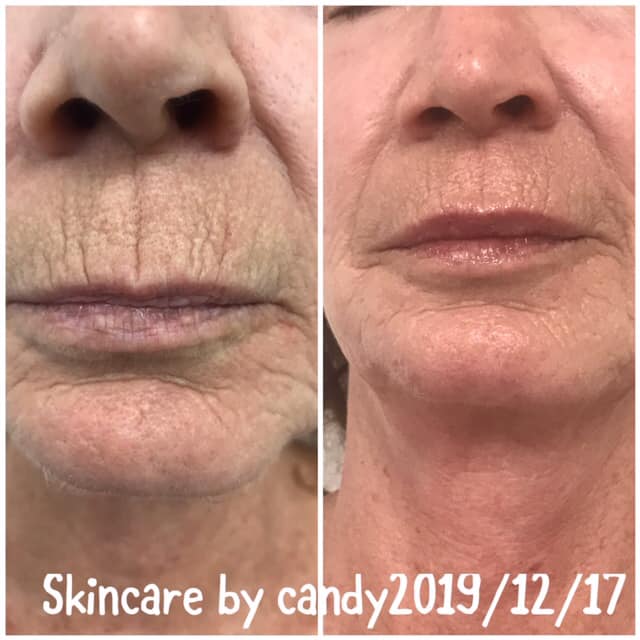 Before & After Photo 2