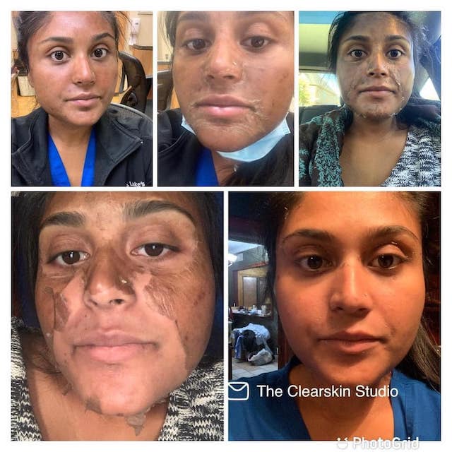 Before & After Photo 20