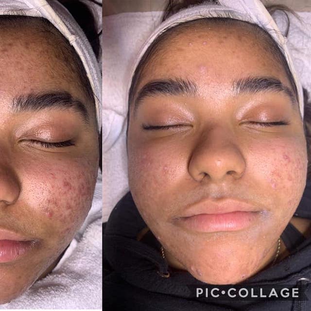 Before & After Photo 24