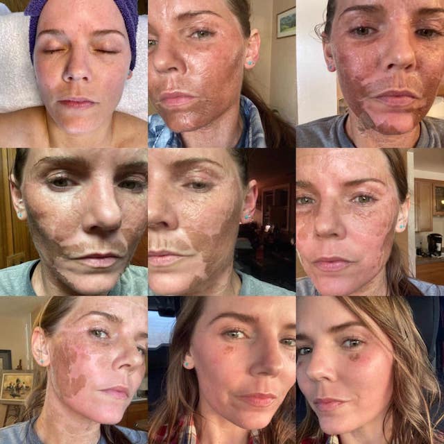 Before & After Photo 25