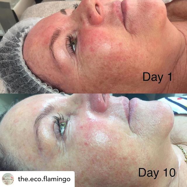 Before & After Photo 27