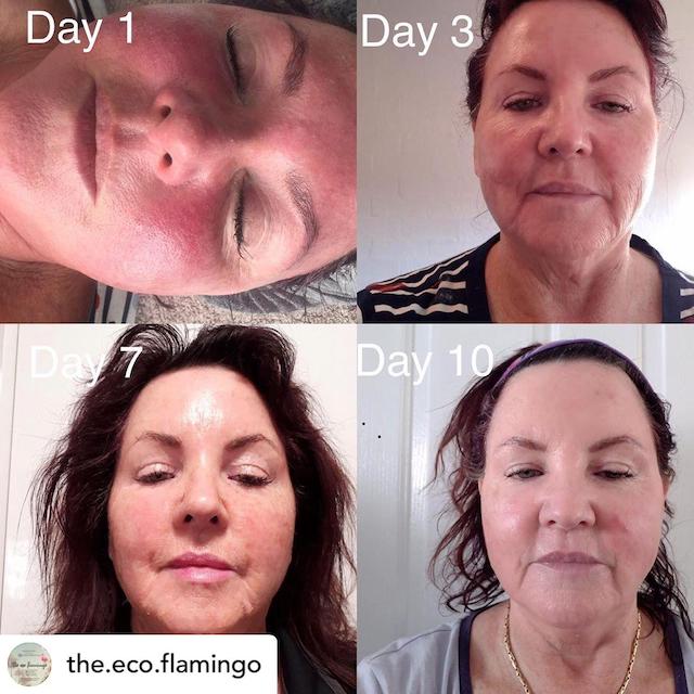 Before & After Photo 28