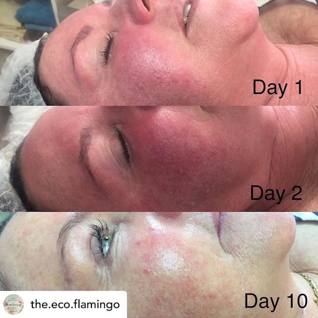 Before & After Photo 29