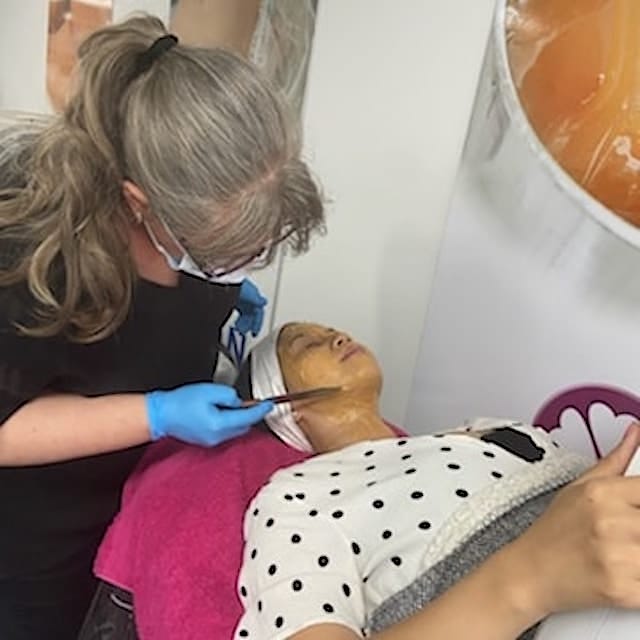 Before & After Photo 31