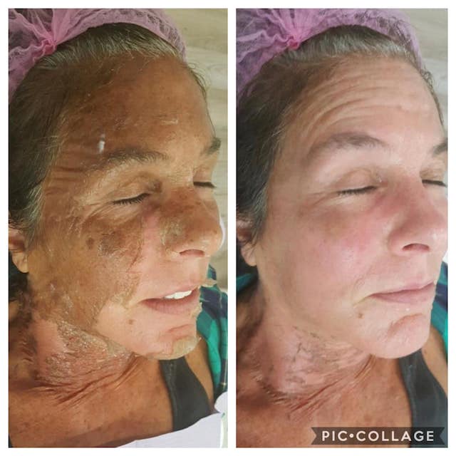 Before & After Photo 4