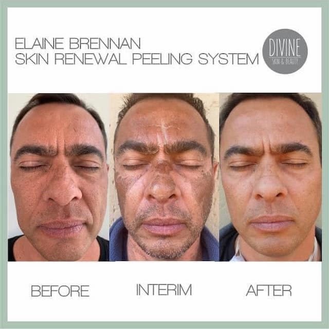 Before & After Photo 6