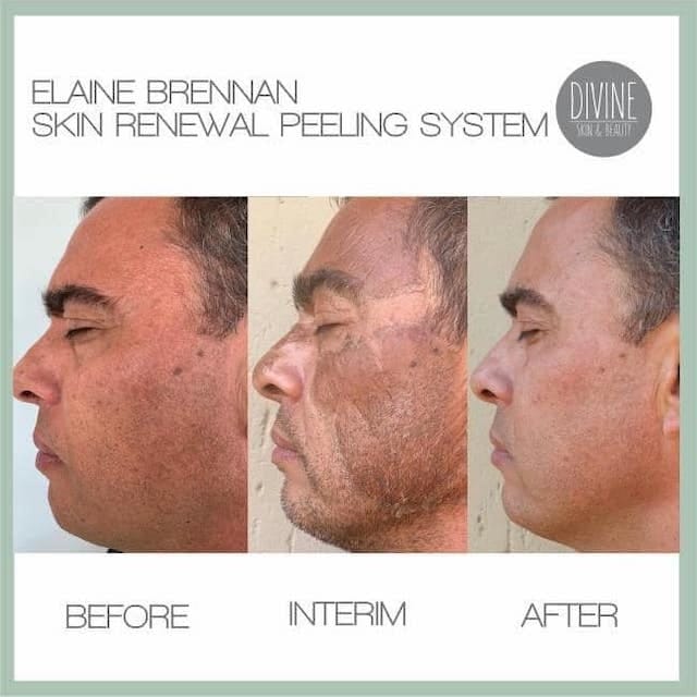 Before & After Photo 9