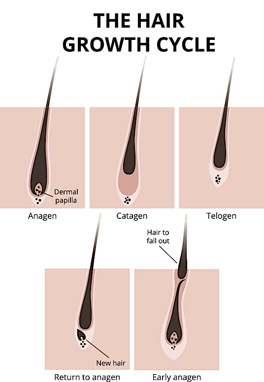 Electrolysis Picture